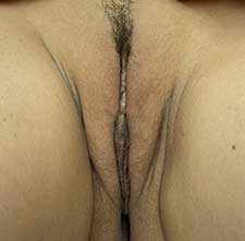labial puff - before