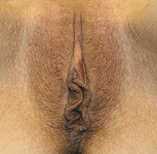 labial puff - before